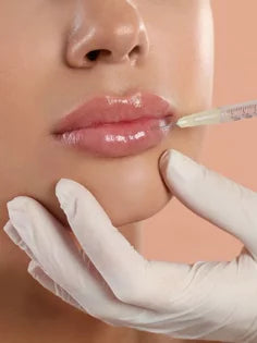 Filler Labbra